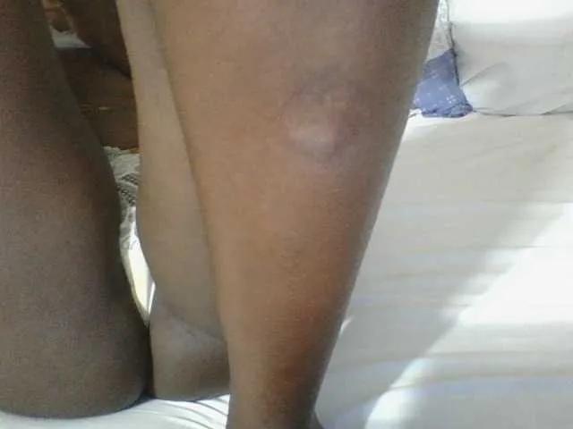 Dizzydose1 on BongaCams 